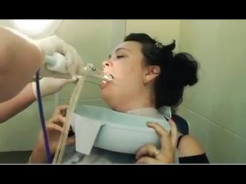 Cách điều trị amidan ở người lớn và trẻ em - mẹo dùng thuốc và dân gian